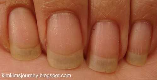 Nails after Gelish