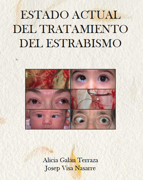 Libro de la doctora Alicia Galán Terraza y José Visa Nasarre sobre el tratamiento del estrabismo
