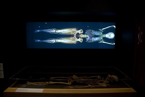 Old skeleton and modern x-ray scan