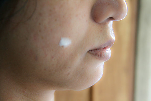 550px-Apply-Toothpaste-on-Pimples-Step-4