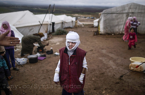 Abdullah Ahmed, 10, who suffered burns in a Syrian government airstrike and fled his home with his family, stands outside their tent at a camp for displaced Syrians in the village of Atmeh, Syria, on December 11, 2012. This tent camp sheltering some of th