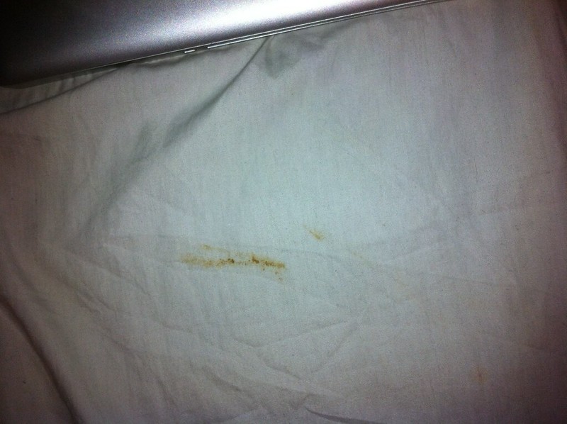 Fecal ID please [a: not bed bug fecal stain] Â« Got Bed Bugs ...