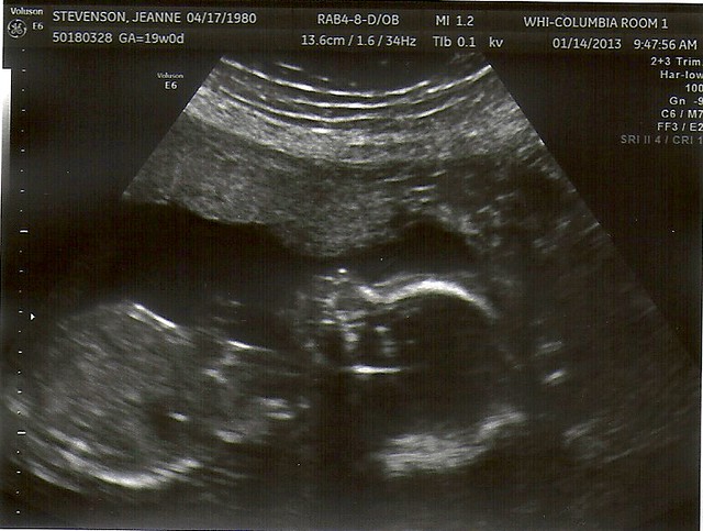 Baby #3 Ultrasound