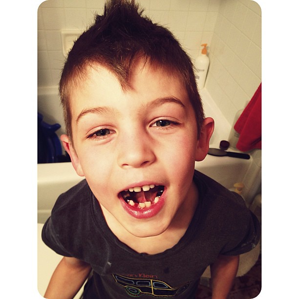 And another tooth bites the dust. #herecometheawkwardyears#vscocam_kids #afterlight