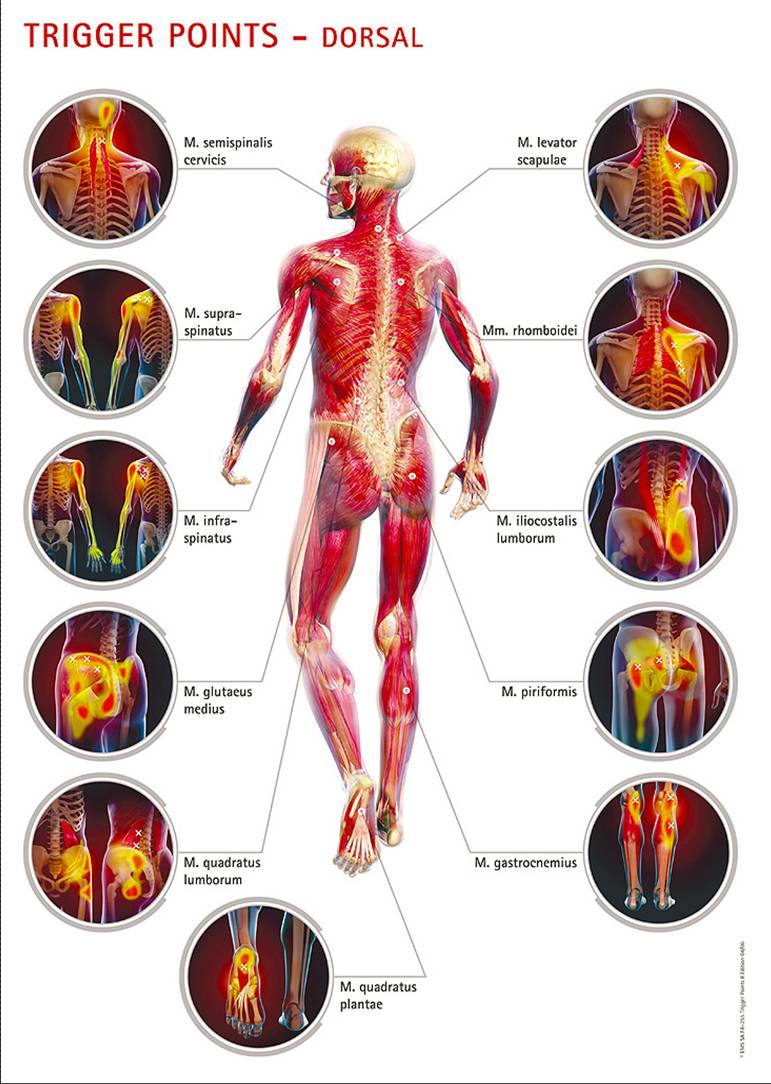 graphic_trigger_points_rear