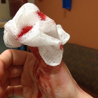 I cut the tip of my thumb off with a mandolin slicer. Yes it hurts. No stitches.