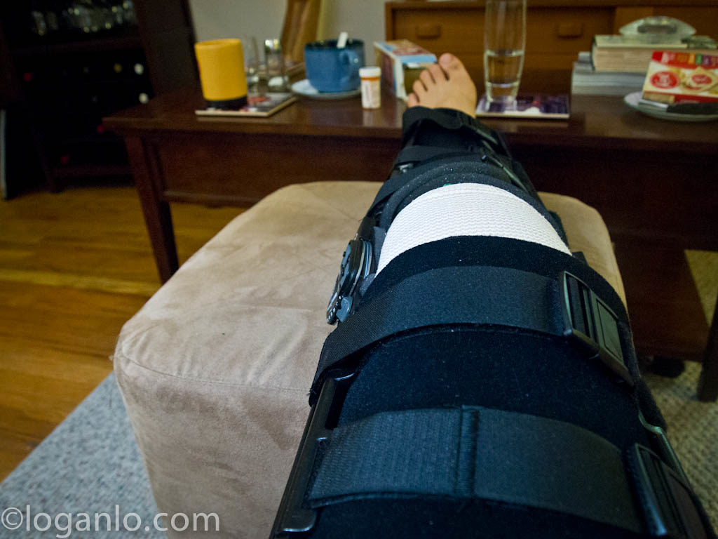 ACL injury in a leg brace