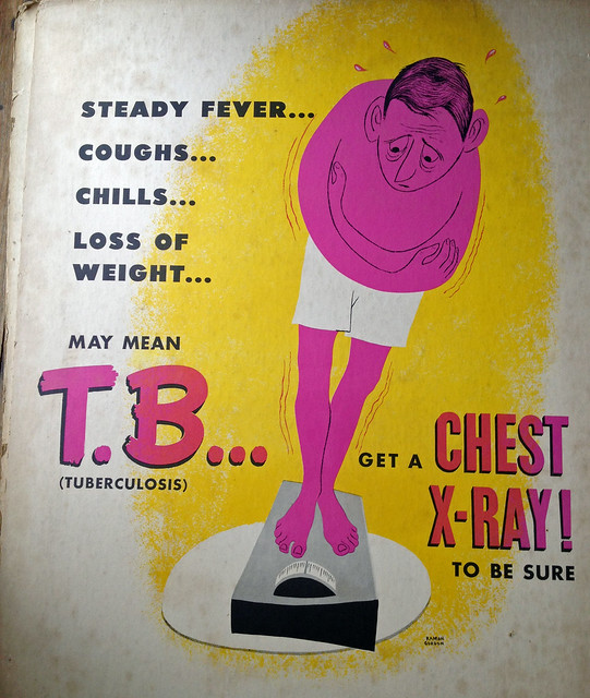 TB-chest xray.jpg
