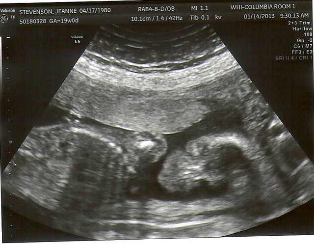 Baby #3 Ultrasound