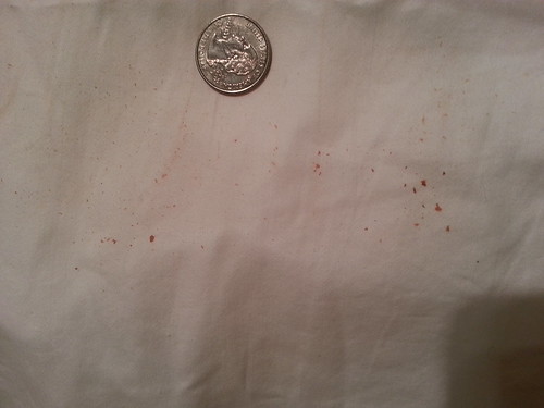 Blood stains on pillow: Bedbug related? [a: blood stains can't confirm ...