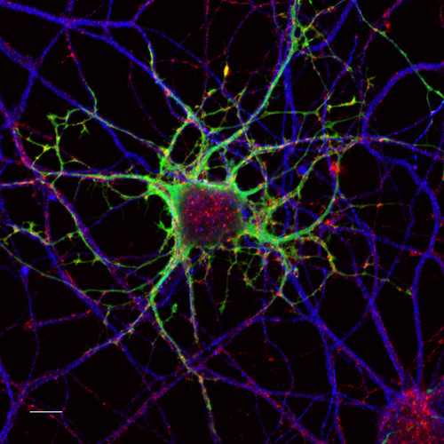 Neurons, confocal fluorescence microscopy