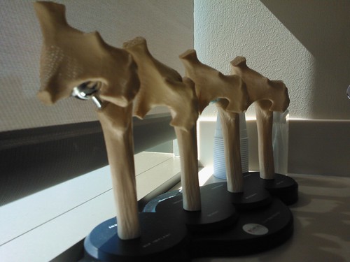Bone replacement models, Dr. Frederick B. Lee's office, Orthopedic Surgery, Swedish Medical Center, Pill Hill, Seattle, Washington, USA by Wonderlane