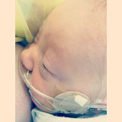 This little lady has the longest eyelashes! Avery, day 56. #twins #preemie #nicu