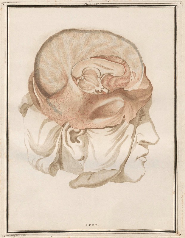 degloved cranial skin, removed skull and exposed intact brain scientific drawing 1780s French teaching thesis