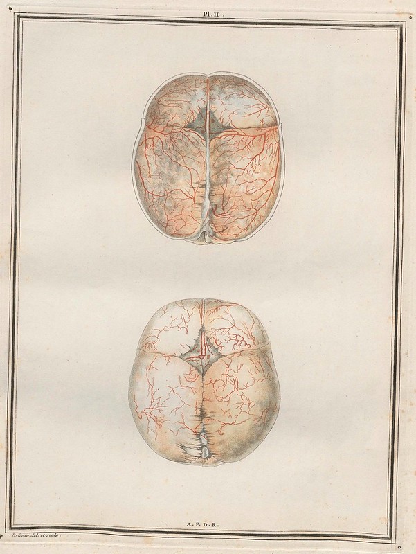 2 x anatomical cross-sections of a brain