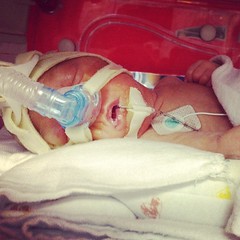 Avery. Day 23. #twins #preemie