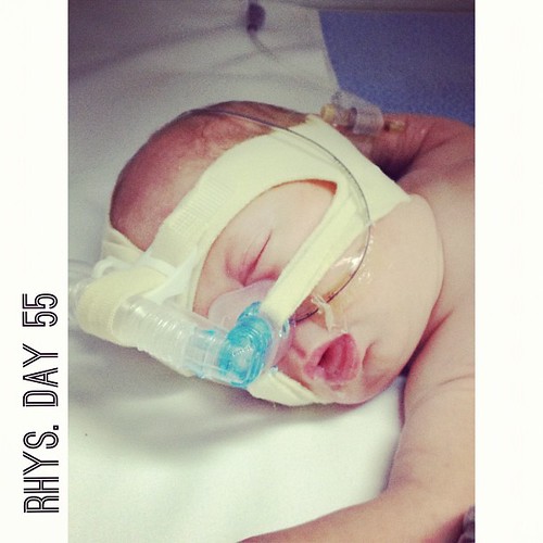 Poor Master Rhys caught a cold! Back on cpap for a little help while he heals. #preemie #nicu #twins