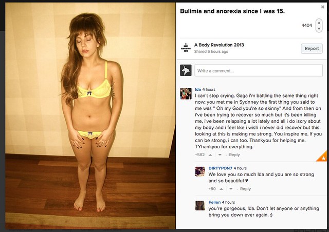 Lady Gaga in her underwear with caption "Bulimia and anorexia since I was 15"