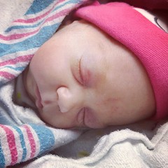 Sweet little girl. Avery. Day 72. #nicu #preemie #twins #28weekpreemie