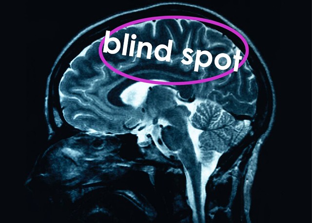BlindSpotBrain