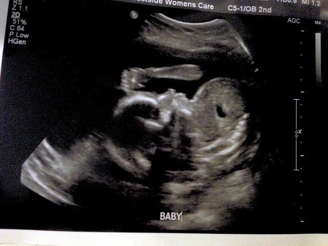 21 week ultrasound for second boy