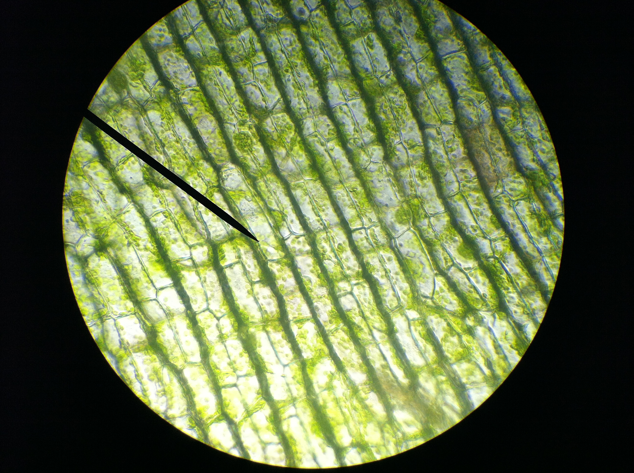 Какую клетку можно увидеть. Хлоропласты листа под микроскопом. Хлоропласт в микроскопе. Хлоропласты листа криптокорины.