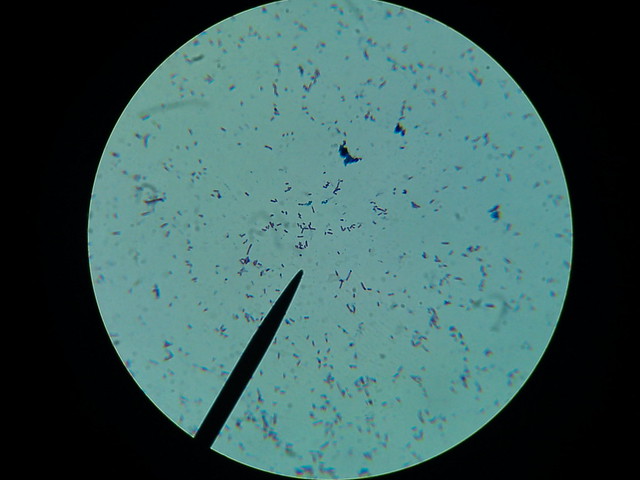 Bacteria smear, Gram stained, Light Microscope - total magnification ...