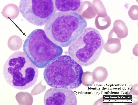 HEMATOLOGY COMPLETE BLOOD COUNT (CBC)