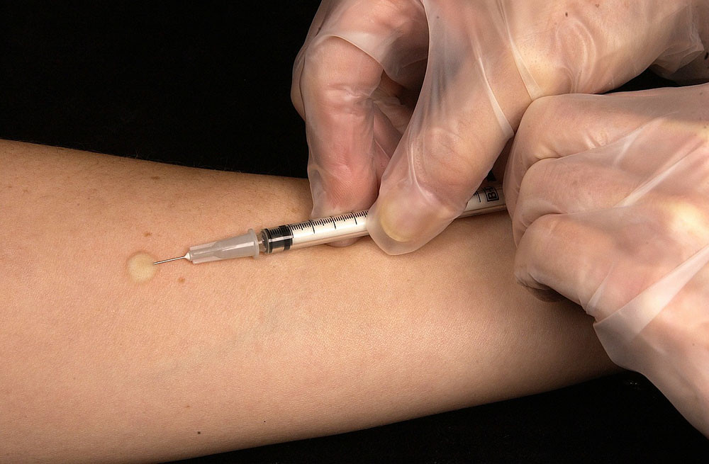 Vaccination Tuberculin Test Syringe Inject Doctor
