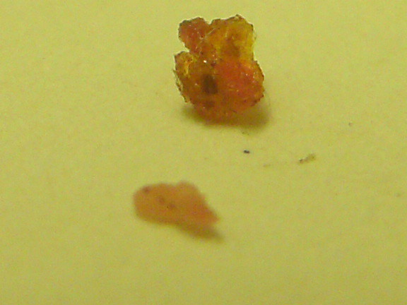 Bed bugs, larvae from human skin | Flickr - Photo Sharing!