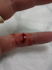 My finger-Christmas 2012