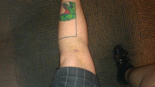 Bruise update by christopher575
