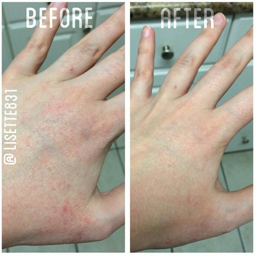  before and after results of hands using DNA Miracles Soothing Ointment