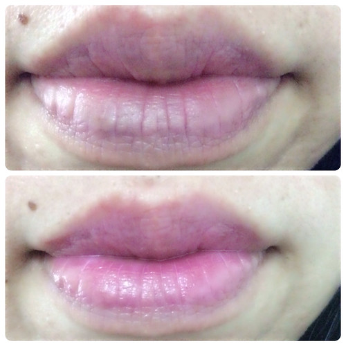 Difference after lip tattoo Shizens
