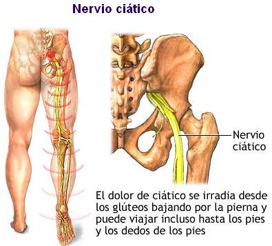 Nervio_Ciatico2 (1)