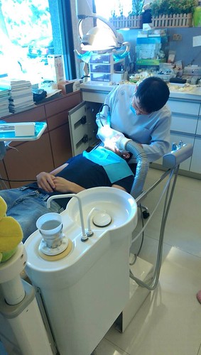 台中豐美牙醫假牙諮詢心得 假牙修磨你可以有更好的選擇 (4)