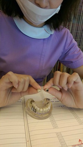 台中豐美牙醫水晶瓷牙打造我的笑容黃金比例 (2)