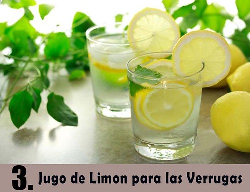 jugo de limon para verrugas